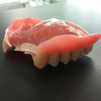 Laboratoire dentaire - Prothèse valplast imprimée