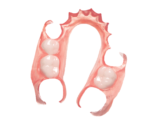 Prothèse dentaire valplast